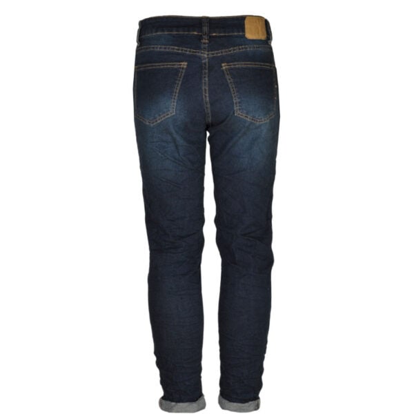 Circle button skinny jeans
